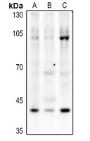 p53 (Acetyl-K319) Rabbit Polyclonal Antibody