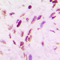 p53 (Acetyl-K319) Rabbit Polyclonal Antibody