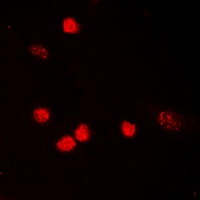 p53 (Acetyl-K319) Rabbit Polyclonal Antibody