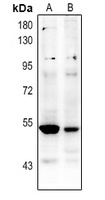 p53 (Acetyl-K381) Rabbit Polyclonal Antibody