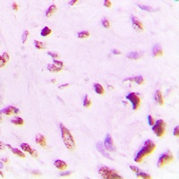 p53 (Acetyl-K381) Rabbit Polyclonal Antibody