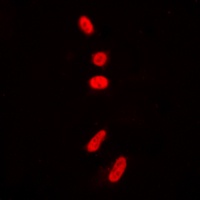 p53 (Acetyl-K381) Rabbit Polyclonal Antibody