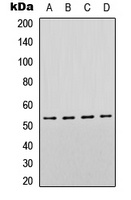p53 Rabbit Polyclonal Antibody