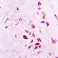 p53 Rabbit Polyclonal Antibody