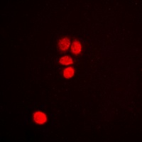 p53 Rabbit Polyclonal Antibody