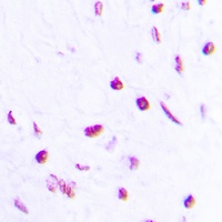 p63 (Phospho-S455) Antibody