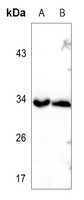 TRADD Rabbit Polyclonal Antibody