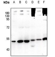 TRIM38 Rabbit Polyclonal Antibody