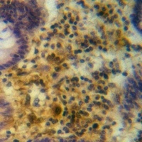 TRIM38 Rabbit Polyclonal Antibody