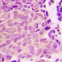 TSC2 (Phospho-S939) Antibody