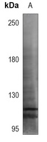 TTF1 Rabbit Polyclonal Antibody