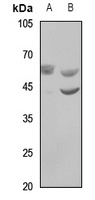WASF3 Rabbit Polyclonal Antibody