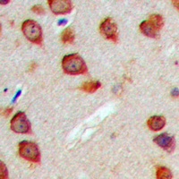 WASF3 Rabbit Polyclonal Antibody