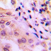 WNK1 (Phospho-T60) Antibody