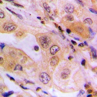 WNK1 Rabbit Polyclonal Antibody