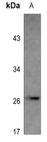 PS1D Rabbit Polyclonal Antibody