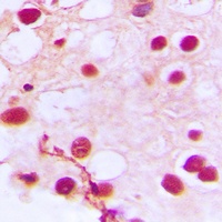 ZNF76 Rabbit Polyclonal Antibody
