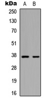 MARCH5 Rabbit Polyclonal Antibody