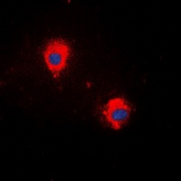 MARCH5 Rabbit Polyclonal Antibody