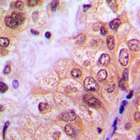ABL1 (Phospho-Y204) Antibody