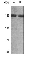 Alpha-adducin (Phospho-T445) Antibody