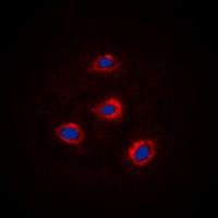 Alpha-adducin Rabbit Polyclonal Antibody