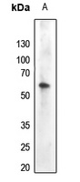 AKT (Phospho-Y474) Rabbit Polyclonal Antibody