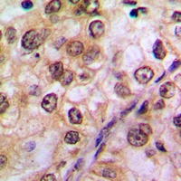 AKT (Phospho-Y474) Rabbit Polyclonal Antibody