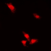 AKT (Phospho-S473) Antibody