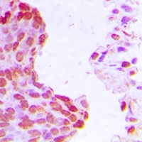 HIF1 beta Rabbit Polyclonal Antibody