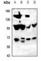 ATG16L2 Rabbit Polyclonal Antibody