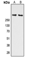 ATM (Phospho-S1981) Rabbit Polyclonal Antibody