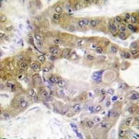 ATP1A1 (Phospho-S16) Rabbit Polyclonal Antibody