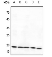 BAD Rabbit Polyclonal Antibody