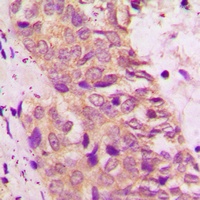 BAD Rabbit Polyclonal Antibody