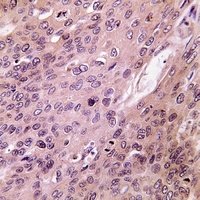 BMP6 Rabbit Polyclonal Antibody