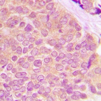 BMX (Phospho-Y566) Antibody