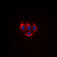 BMX (Phospho-Y566) Antibody