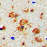 CaMK2 beta/gamma (Phospho-T287) Antibody