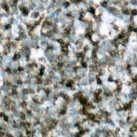 c-CBL (Phospho-Y700) Antibody