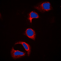 c-CBL (Phospho-Y700) Antibody