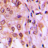 Cyclin D1 (Phospho-T286) Antibody