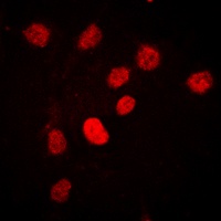 C/EBP beta (Phospho-T235) Antibody