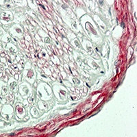 Collagen 4 alpha 2 Antibody