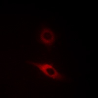 Collagen 4 alpha 2 Antibody