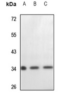 Cytochrome c1 Rabbit Polyclonal Antibody