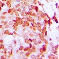 DAXX (Phospho-S668) Antibody