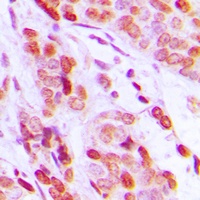 DAXX Rabbit Polyclonal Antibody