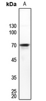 DDX55 Rabbit Polyclonal Antibody