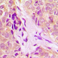 DDX55 Rabbit Polyclonal Antibody